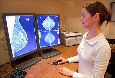 乳腺癌各种分类汇总之二：乳腺癌分子分型